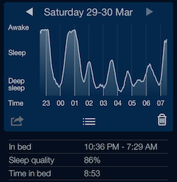 Abnormal sleep waves 